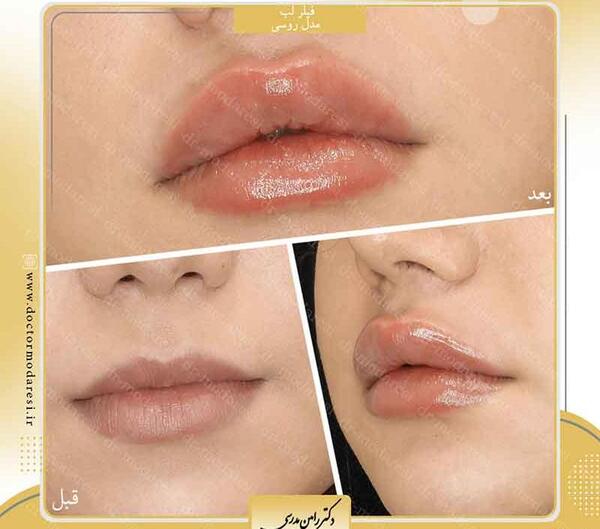 عکس لب طراحی شده