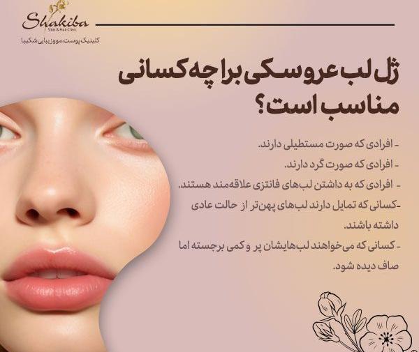 عکس ژل لب عروسکی