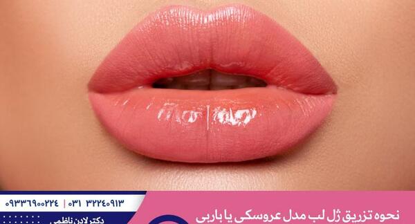 عکس ژل لب عروسکی