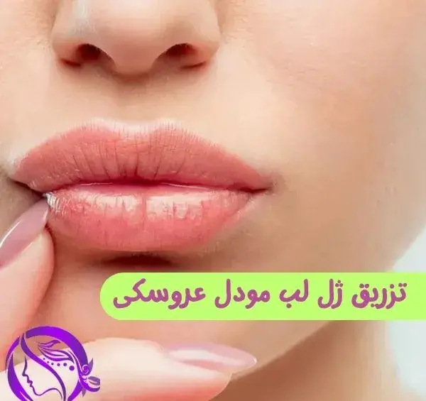 عکس ژل لب عروسکی