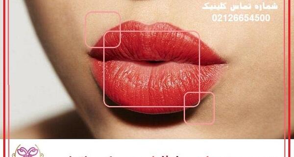 عکس ژل لب عروسکی