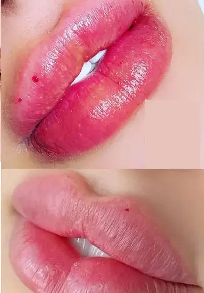 عکس ژل لب عروسکی