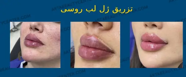 عکس لب روسی عروسکی