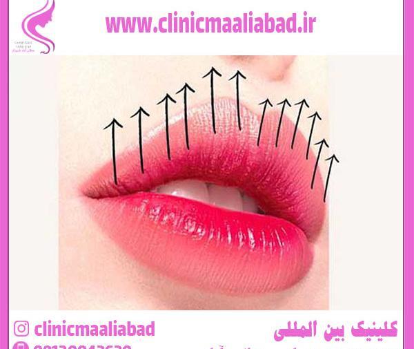 عکس لب قلوه ایی