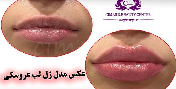 عکس لب قلوه ایی