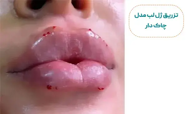 عکس لب قلوه ایی