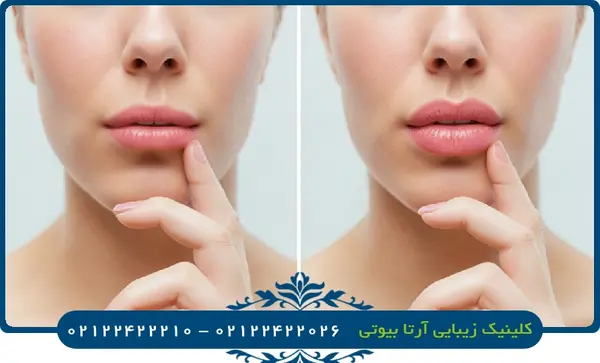 عکس لب قلبی شکل