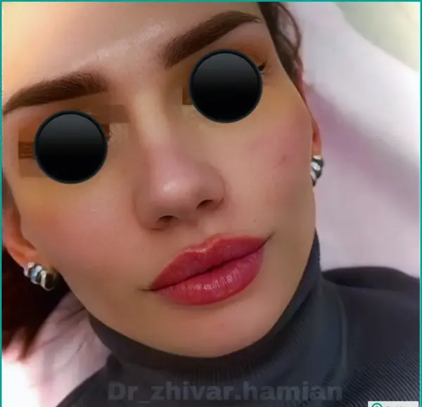 عکس لب قلبی شکل