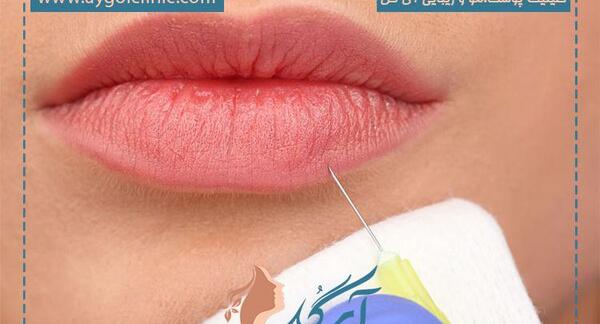 عکس رژ لب قلبی