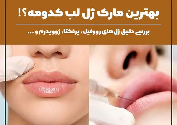 عکس ژل لب کره ای
