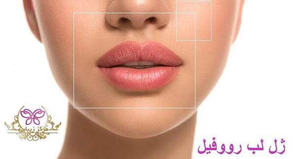 عکس ژل لب کره ای