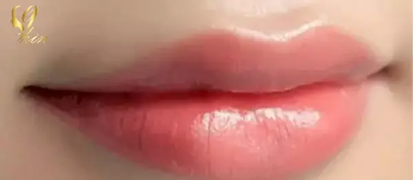 عکس ژل لب کره ای