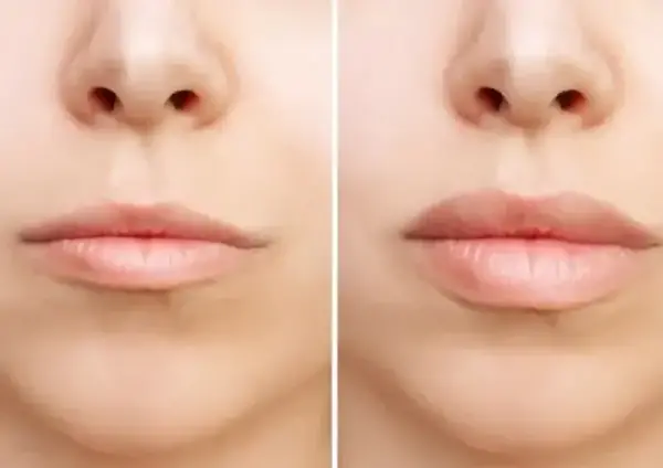عکس کوچکترین لب دنیا