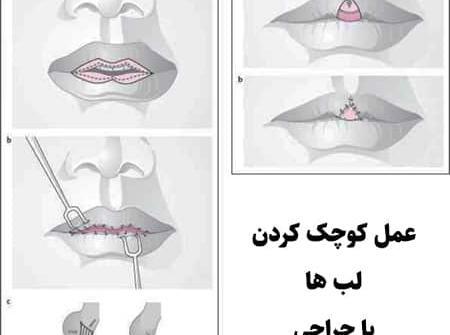عکس کوچکترین لب دنیا