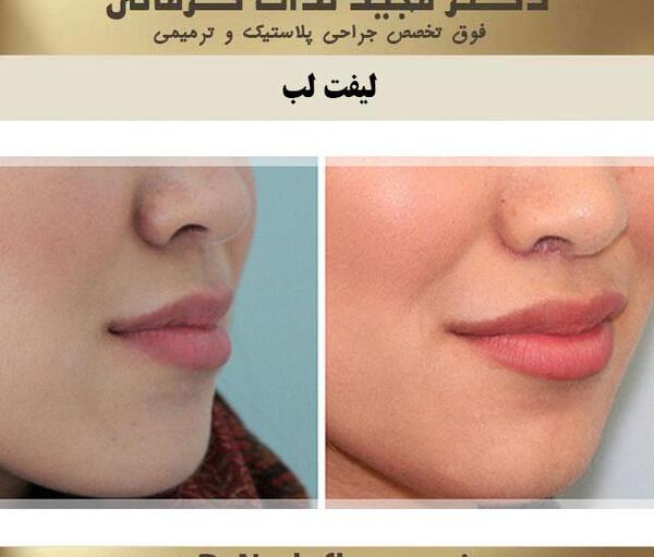 عکس کوچکترین لب