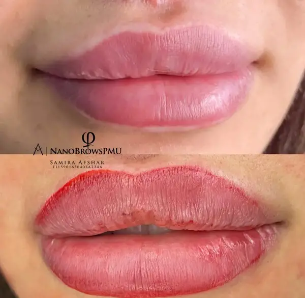 عکس خط لب کالباسی