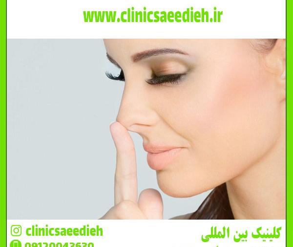 عکس لیفت لب با نخ