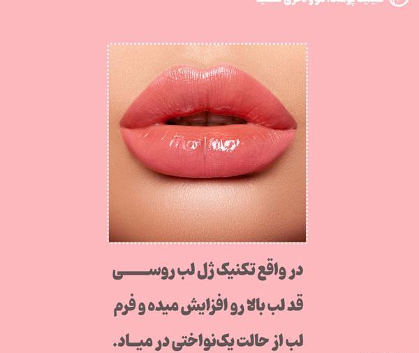 عکس لیفت لب روسی