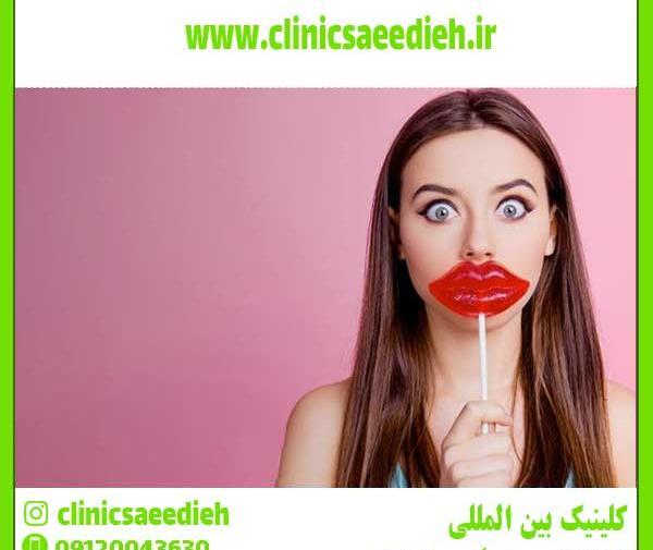 عکس لیفت لب بالا
