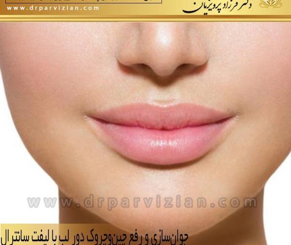 عکس لیفت لب بالا