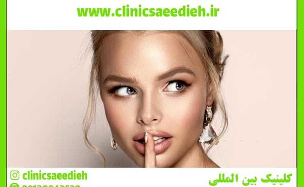 عکس لب لیفت شده