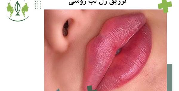 عکس فیلر لب مدل روسی