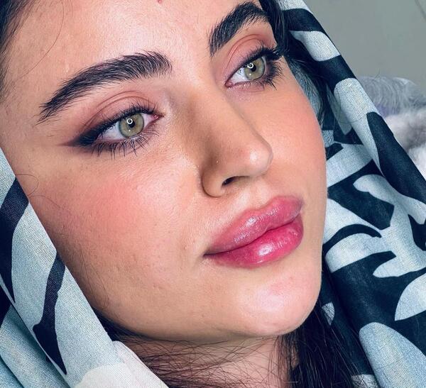 عکس فیلر لب مدل روسی