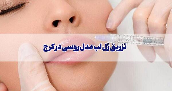 عکس فیلر لب مدل روسی