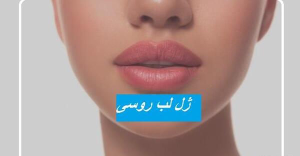 عکس پروتز لب مدل روسی
