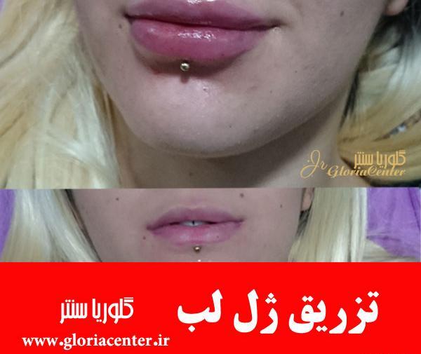 عکس یه سیسی ژل لب