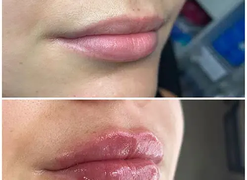 عکس یه سیسی ژل لب