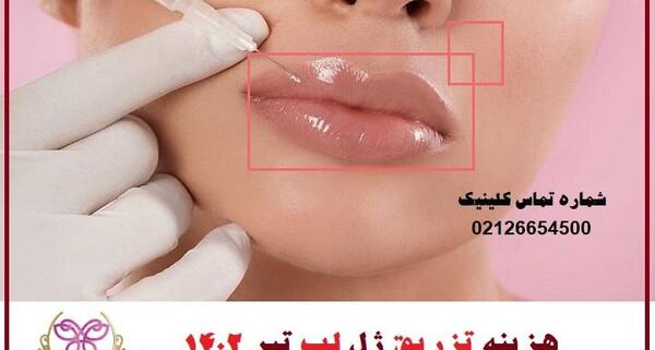 عکس یه سیسی ژل لب