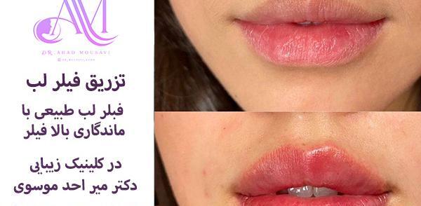 عکس یه سیسی ژل لب