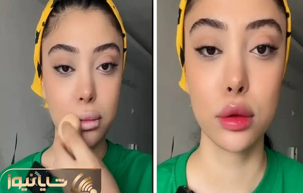 عکس لب های کره ای