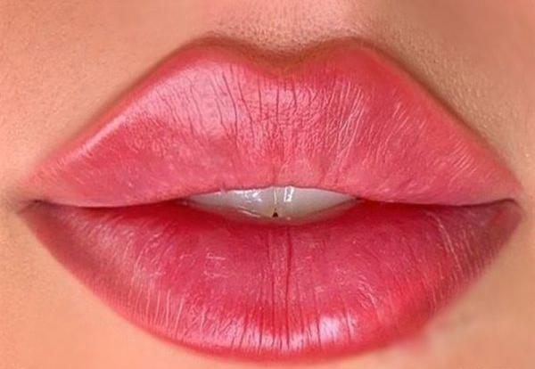 عکس لب های پروتز