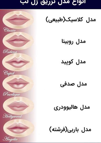 عکس لب های پروتز