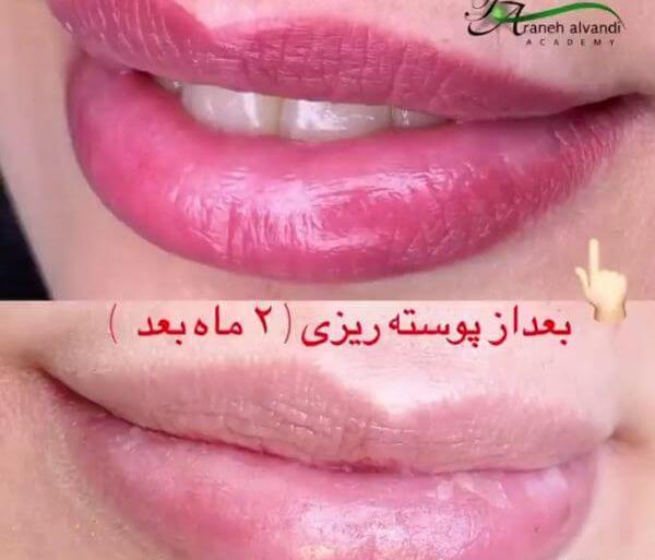 عکس لب های کبود