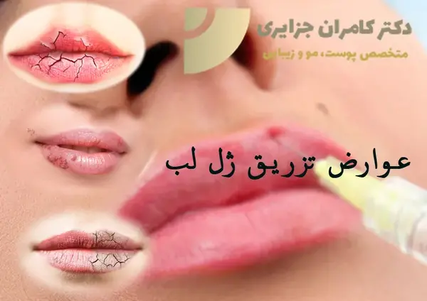 عکس لب های کبود