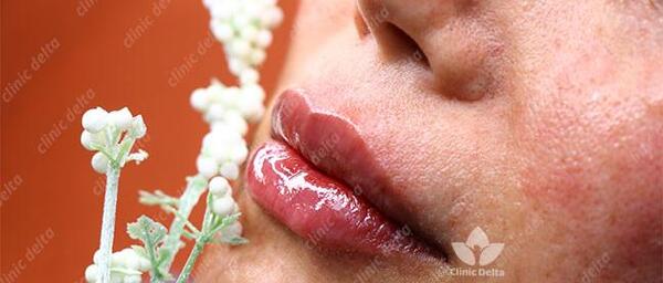 عکس لب های کبود