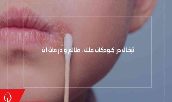 عکس تاول لب نوزاد