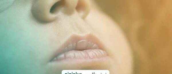 عکس تاول لب نوزاد