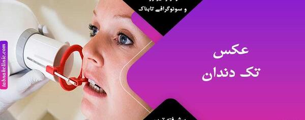 عکس لب دندان