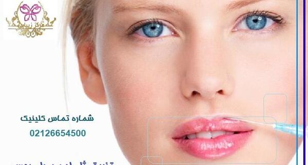 عکس تزریق لب مدل روسی