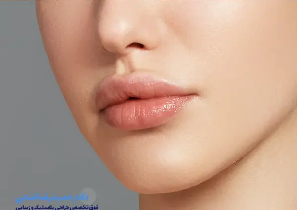 عکس لیفت سانترال لب
