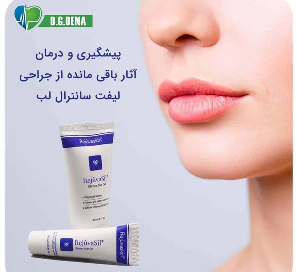 عکس لیفت سانترال لب