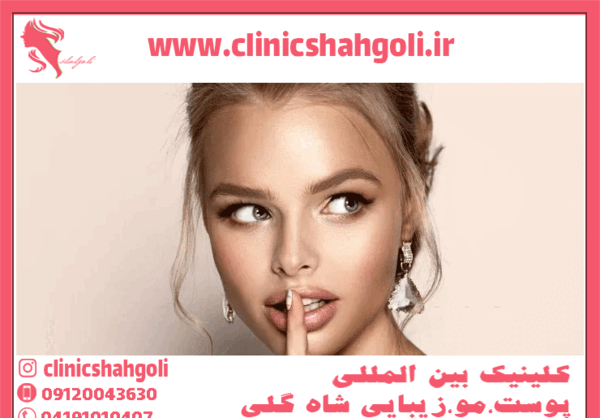 عکس قبل و بعد لیفت لب