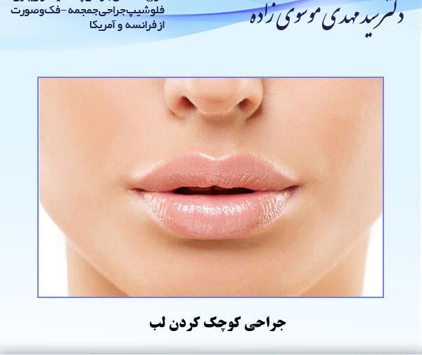 عکس لب خیلی کوچک