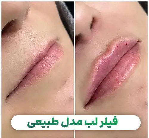 عکس لب های کوچک
