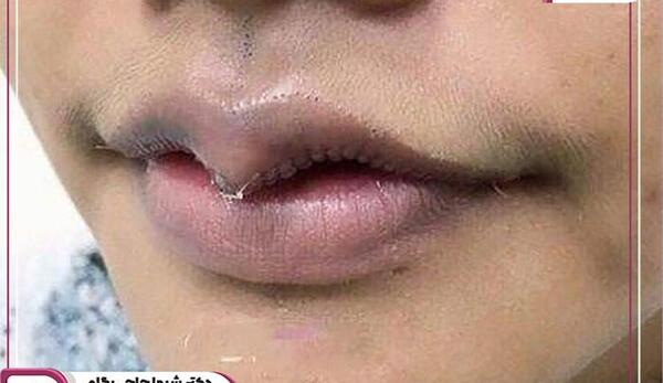 عکس لب های کوچک