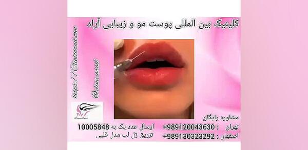 عکس مدل لب قلبی